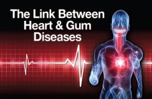 heart-gum-diseases image