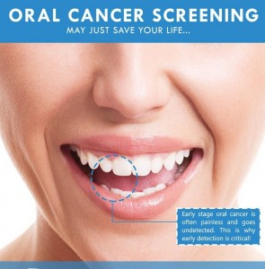 oral cancer image