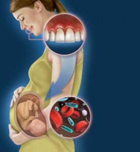 pregnancy and dental health